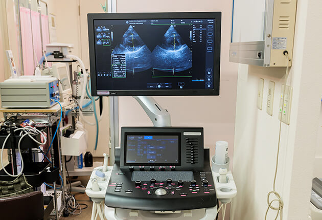 超音波エコー診断装置